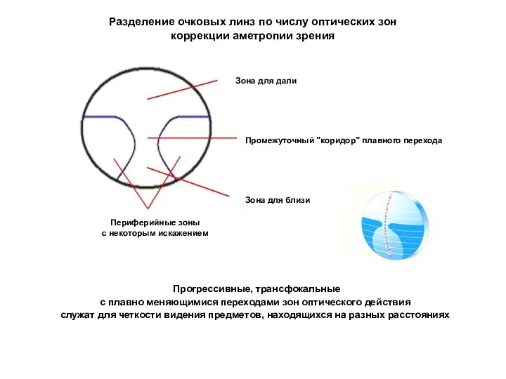 Прогрессивные, трансфокальные с плавно меняющимися переходами зон оптического действия служат для