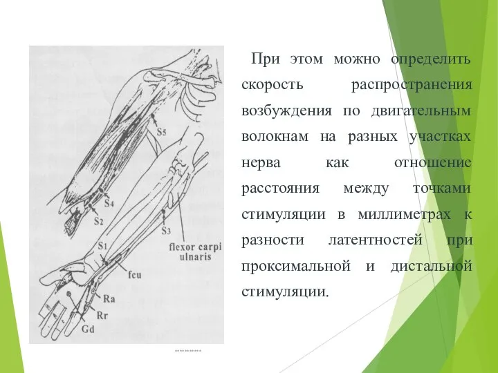 При этом можно определить скорость распространения возбуждения по двигательным волокнам на