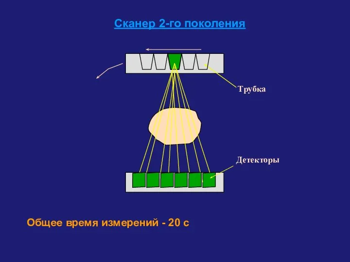 Трубка Детекторы Сканер 2-го поколения Общее время измерений - 20 с