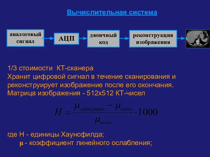 Вычислительная система 1/3 стоимости КТ-сканера Хранит цифровой сигнал в течение сканирования