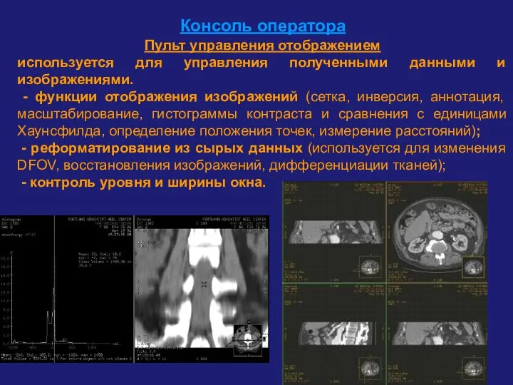 Консоль оператора Пульт управления отображением используется для управления полученными данными и