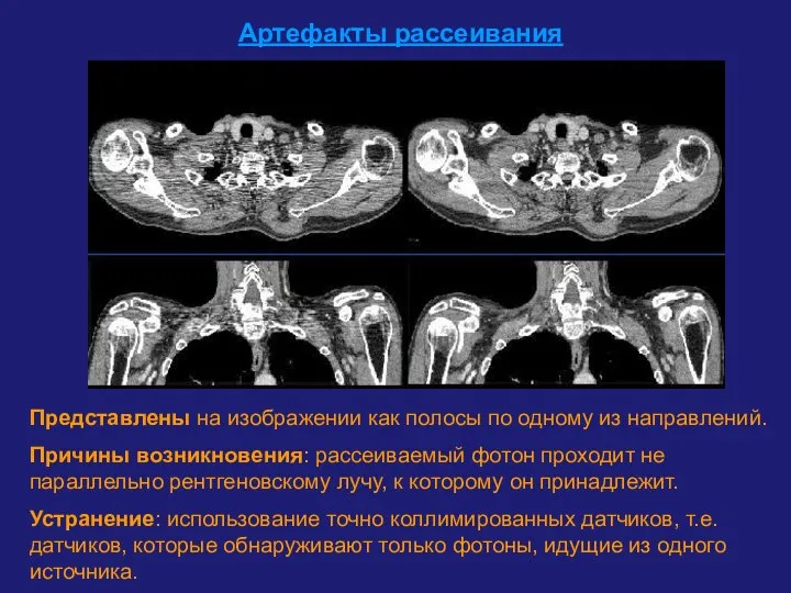 Артефакты рассеивания Представлены на изображении как полосы по одному из направлений.