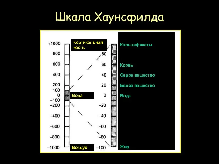 Шкала Хаунсфилда