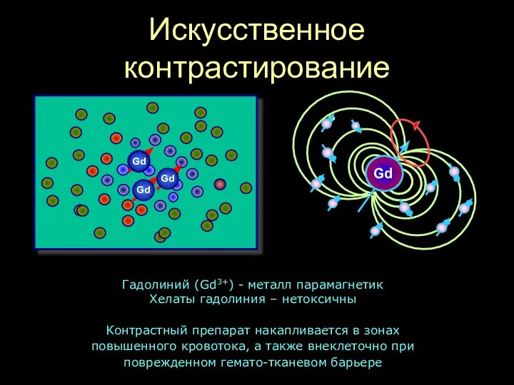 Искусственное контрастирование Гадолиний (Gd3+) - металл парамагнетик Хелаты гадолиния – нетоксичны