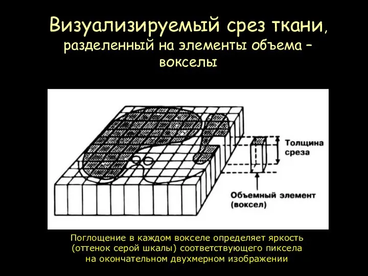 Визуализируемый срез ткани, разделенный на элементы объема – вокселы Поглощение в