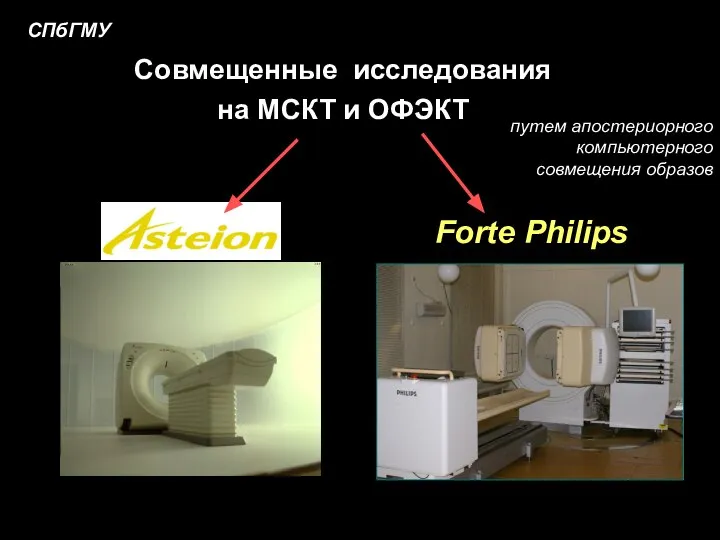 Forte Philips СПбГМУ Совмещенные исследования на МСКТ и ОФЭКТ путем апостериорного компьютерного совмещения образов