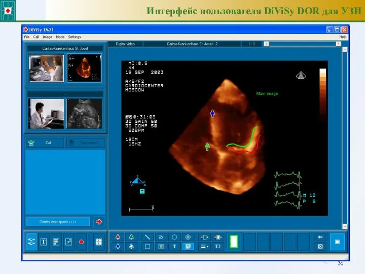 Интерфейс пользователя DiViSy DOR для УЗИ