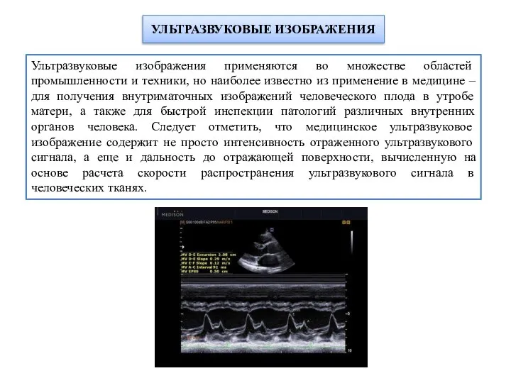 УЛЬТРАЗВУКОВЫЕ ИЗОБРАЖЕНИЯ Ультразвуковые изображения применяются во множестве областей промышленности и техники,