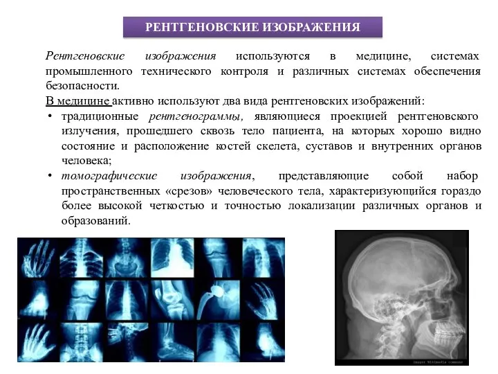 РЕНТГЕНОВСКИЕ ИЗОБРАЖЕНИЯ Рентгеновские изображения используются в медицине, системах промышленного технического контроля