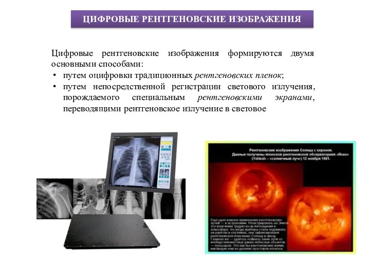 ЦИФРОВЫЕ РЕНТГЕНОВСКИЕ ИЗОБРАЖЕНИЯ Цифровые рентгеновские изображения формируются двумя основными способами: путем