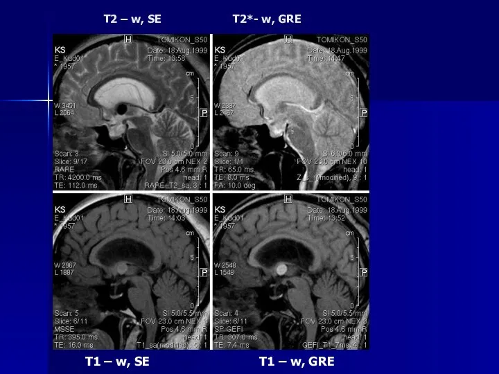 T2 – w, SE T2*- w, GRE T1 – w, SE T1 – w, GRE