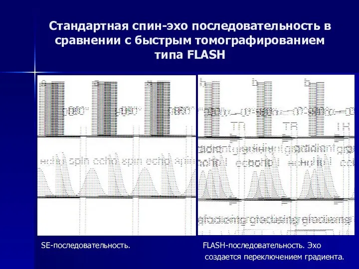 Стандартная спин-эхо последовательность в сравнении с быстрым томографированием типа FLASH SE-последовательность. FLASH-последовательность. Эхо создается переключением градиента.