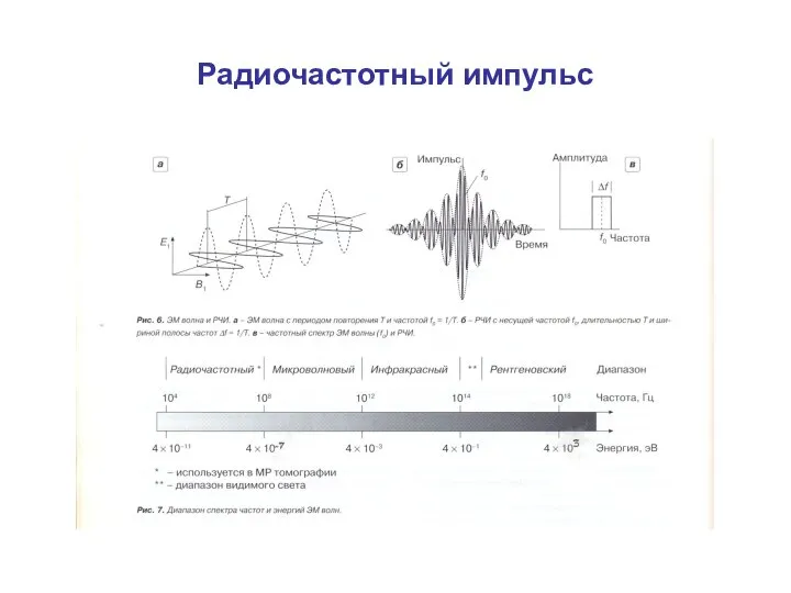 Радиочастотный импульс