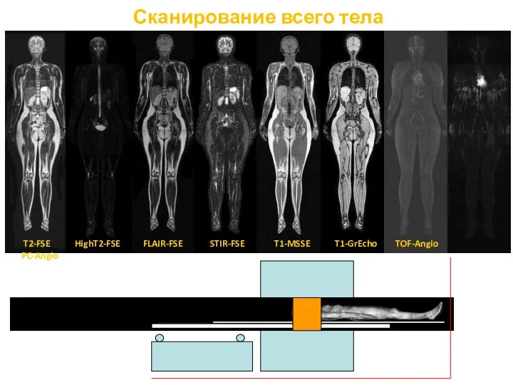 Сканирование всего тела