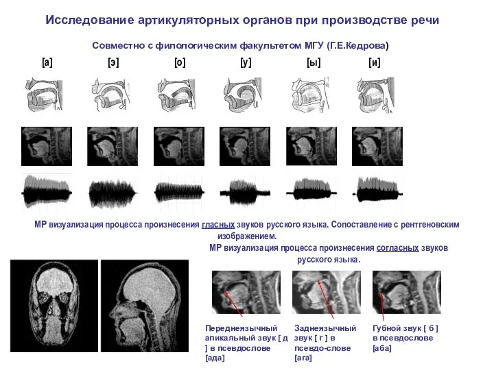 Исследование артикуляторных органов при производстве речи МР визуализация процесса произнесения гласных