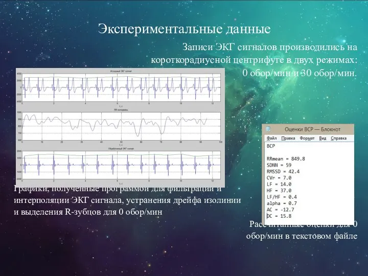 Экспериментальные данные Записи ЭКГ сигналов производились на короткорадиусной центрифуге в двух