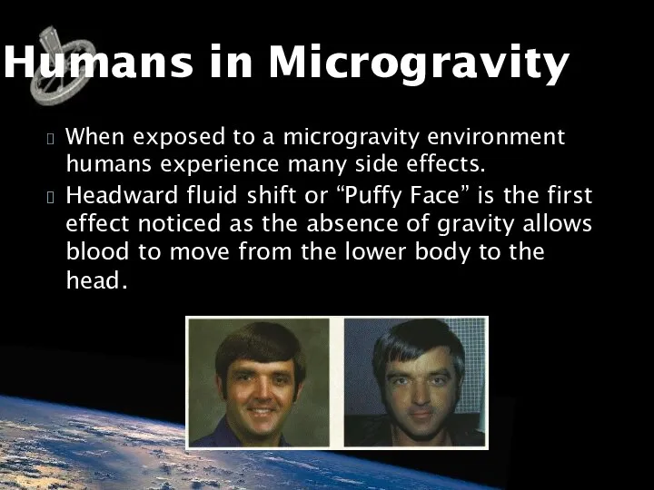 When exposed to a microgravity environment humans experience many side effects.