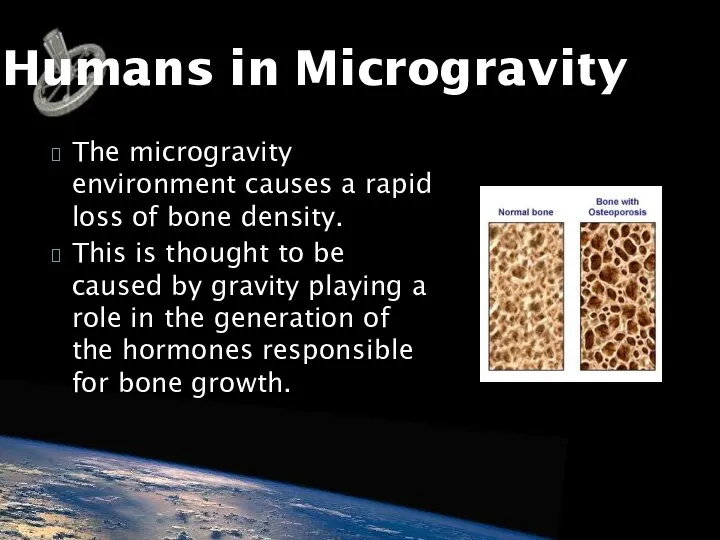 The microgravity environment causes a rapid loss of bone density. This