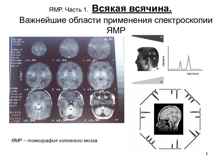 ЯМР. Часть 1. Всякая всячина. Важнейшие области применения спектроскопии ЯМР ЯМР – томография головного мозга