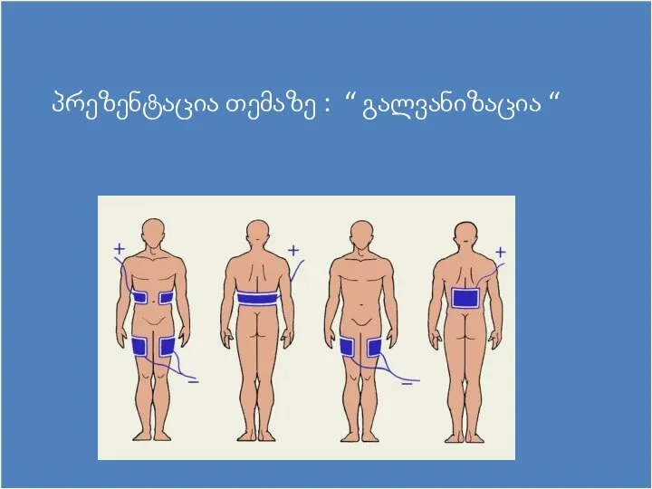 პრეზენტაცია თემაზე : “ გალვანიზაცია “