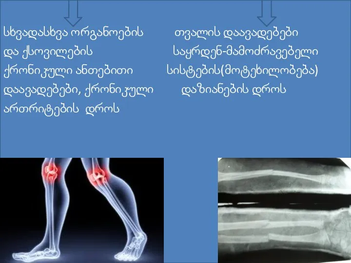სხვადასხვა ორგანოების თვალის დაავადებები და ქსოვილების საყრდენ-მამოძრავებელი ქრონიკული ანთებითი სისტების(მოტეხილობება) დაავადებები, ქრონიკული დაზიანების დროს ართრიტების დროს