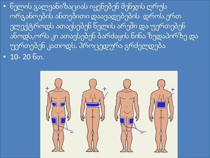 წელის გალვანიზაციას იყენებენ მენჯის ღრუს ორგანოების ანთებითი დაავადებების დროს.ერთ ელექტროდს ათავსებენ