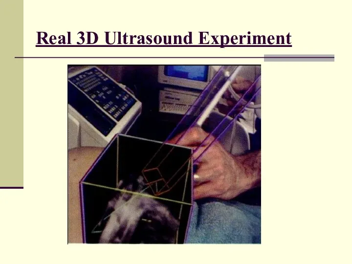 Real 3D Ultrasound Experiment