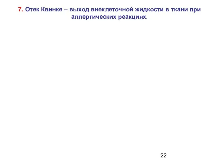 7. Отек Квинке – выход внеклеточной жидкости в ткани при аллергических реакциях.