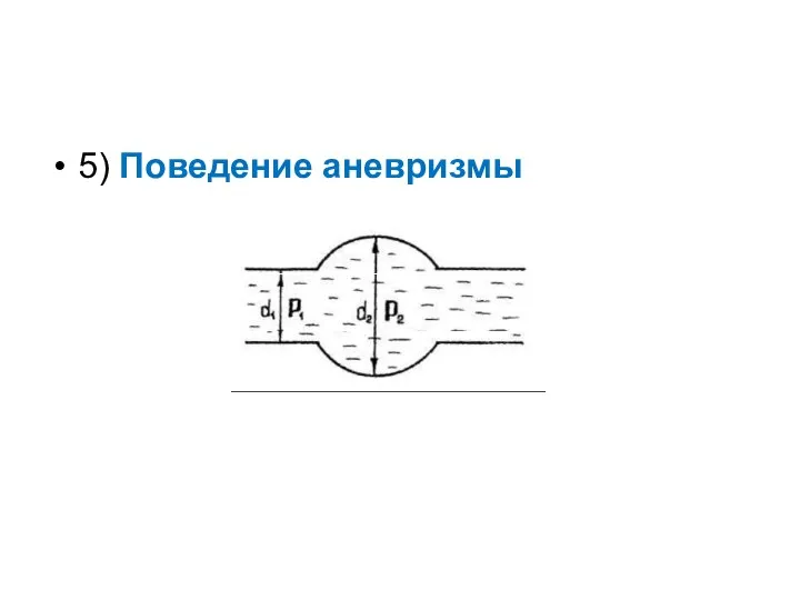 5) Поведение аневризмы