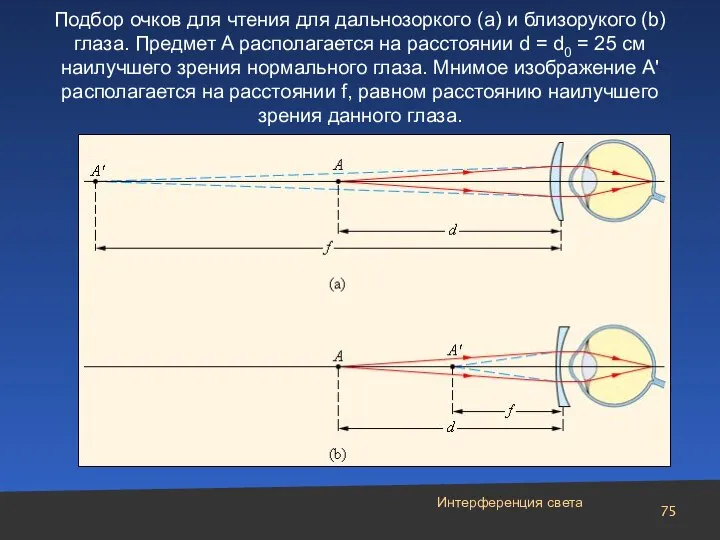 Подбор очков для чтения для дальнозоркого (a) и близорукого (b) глаза.