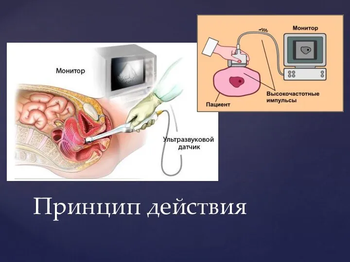 Принцип действия