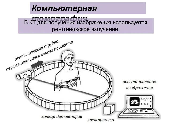 Компьютерная томография В КТ для получения изображения используется рентгеновское излучение.
