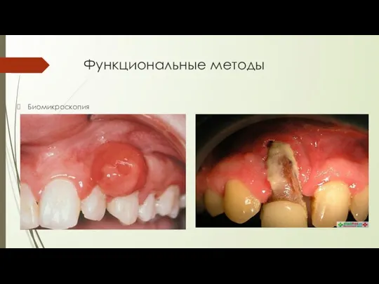 Функциональные методы Биомикроскопия