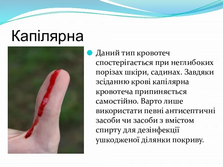 Капілярна Даний тип кровотеч спостерігається при неглибоких порізах шкіри, садинах. Завдяки