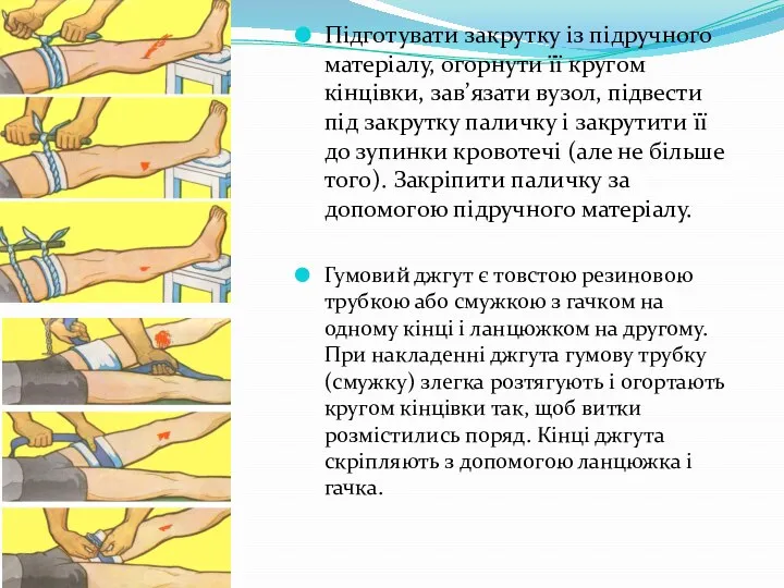 Підготувати закрутку із підручного матеріалу, огорнути її кругом кінцівки, зав’язати вузол,