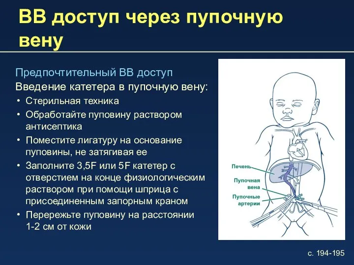 ВВ доступ через пупочную вену Предпочтительный ВВ доступ Введение катетера в