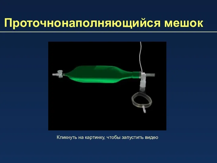 Проточнонаполняющийся мешок Кликнуть на картинку, чтобы запустить видео