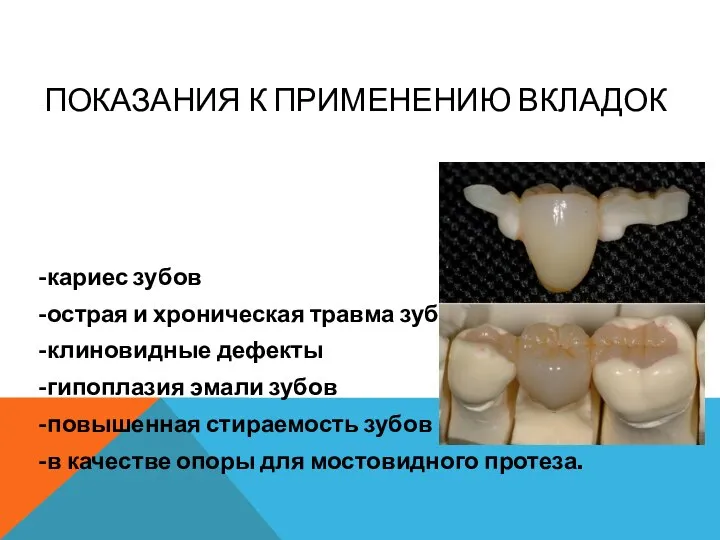 ПОКАЗАНИЯ К ПРИМЕНЕНИЮ ВКЛАДОК -кариес зубов -острая и хроническая травма зубов