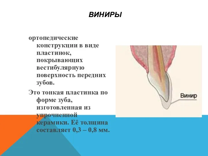 ВИНИРЫ ортопедические конструкции в виде пластинок, покрывающих вестибулярную поверхность передних зубов.