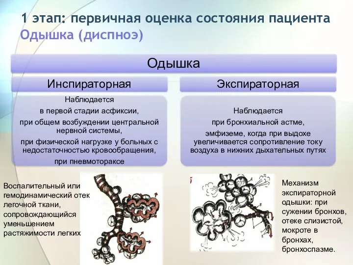 1 этап: первичная оценка состояния пациента Одышка (диспноэ) Воспалительный или гемодинамический