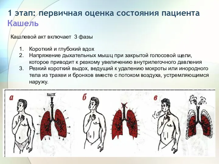 1 этап: первичная оценка состояния пациента Кашель Кашлевой акт включает 3