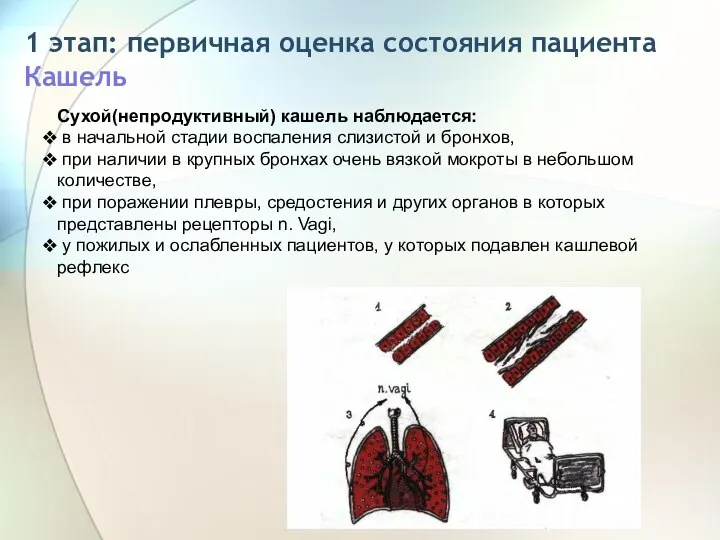 1 этап: первичная оценка состояния пациента Кашель Сухой(непродуктивный) кашель наблюдается: в