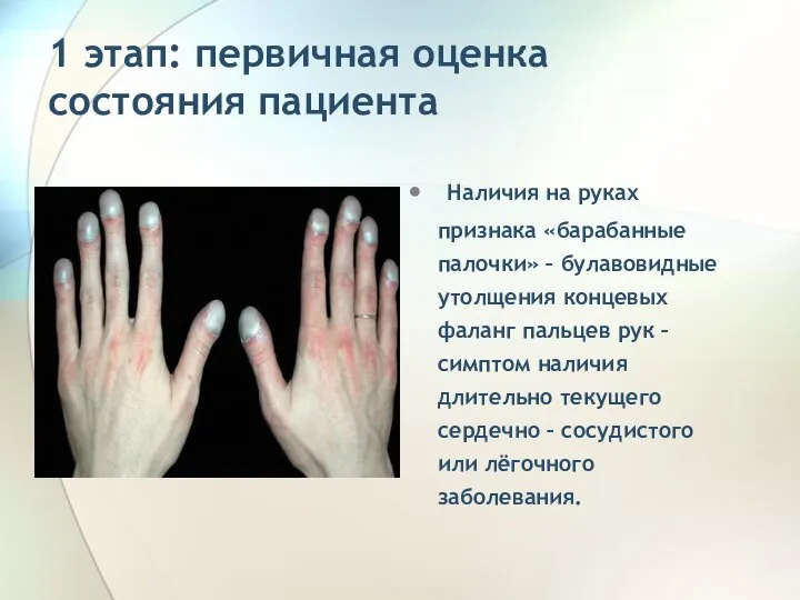 1 этап: первичная оценка состояния пациента Наличия на руках признака «барабанные