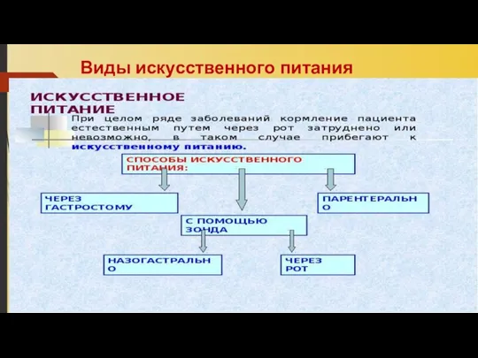 Виды искусственного питания