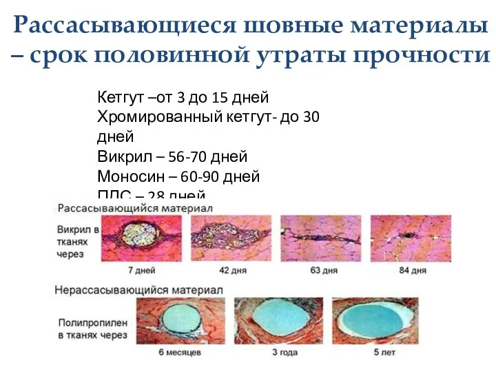 Рассасывающиеся шовные материалы – срок половинной утраты прочности Кетгут –от 3