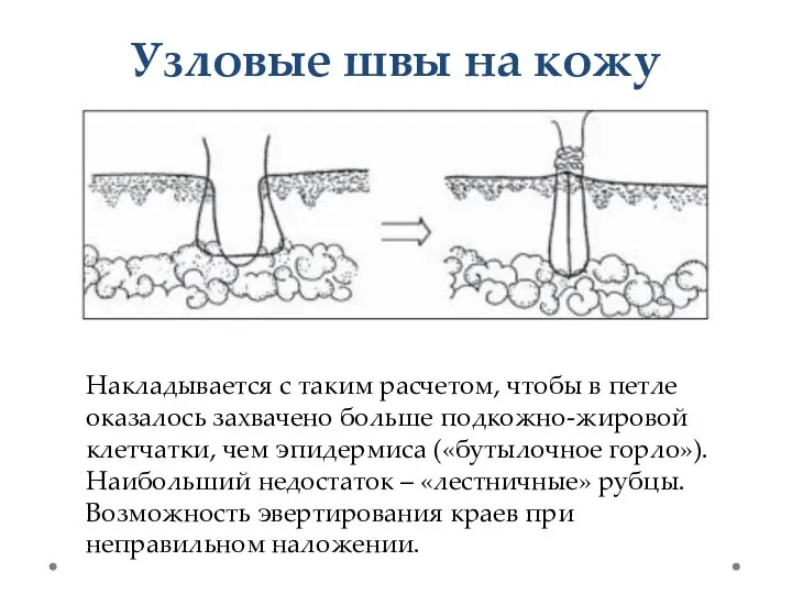 Узловые швы на кожу Накладывается с таким расчетом, чтобы в петле