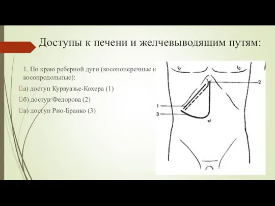 Доступы к печени и желчевыводящим путям: 1. По краю реберной дуги