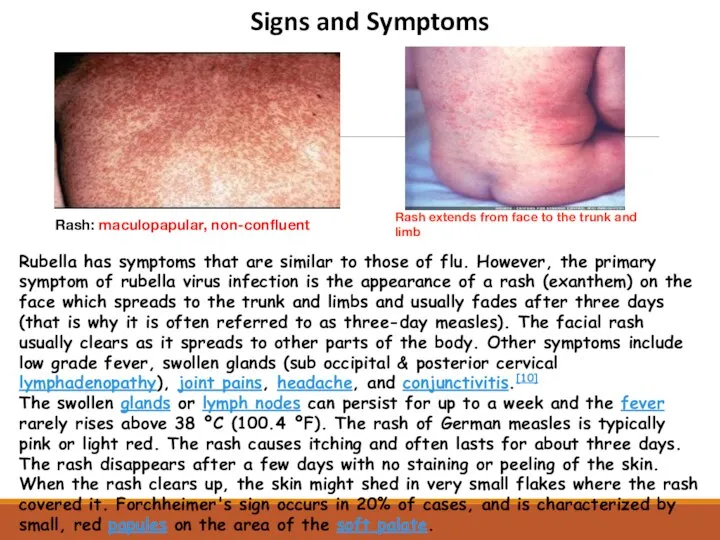 Rash extends from face to the trunk and limb Rash: maculopapular,