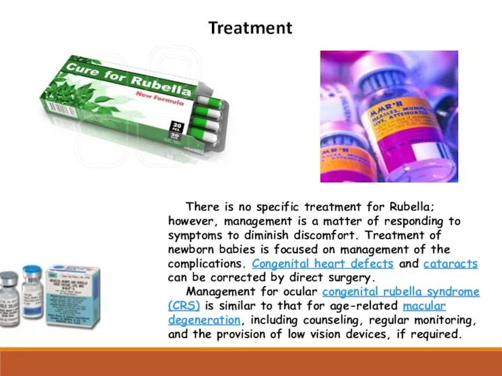 Treatment There is no specific treatment for Rubella; however, management is