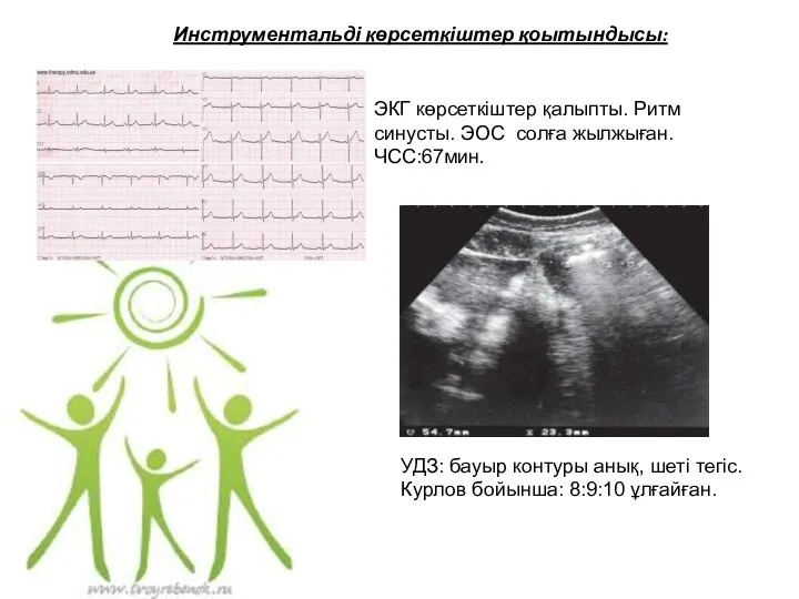 Инструментальді көрсеткіштер қоытындысы: ЭКГ көрсеткіштер қалыпты. Ритм синусты. ЭОС солға жылжыған.